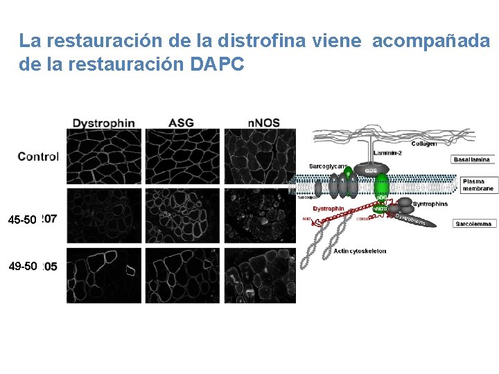 La restauración de la distrofina viene acompañada de la restauración DAPC Control muscle 45