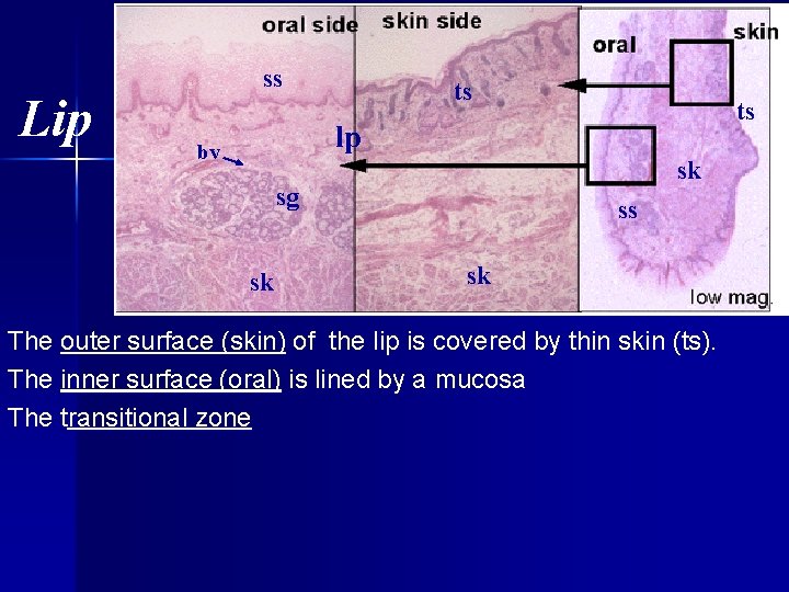 oral side Lip ss skin side skin oral ts ts lp bv sk sg