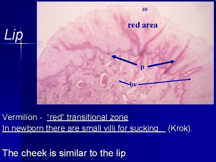 ss Lip red area p bv Vermilion - “red” transitional zone In newborn there