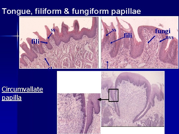 Tongue, filiform & fungiform papillae ss ss fili ct Circumvallate papilla ct fili fungi