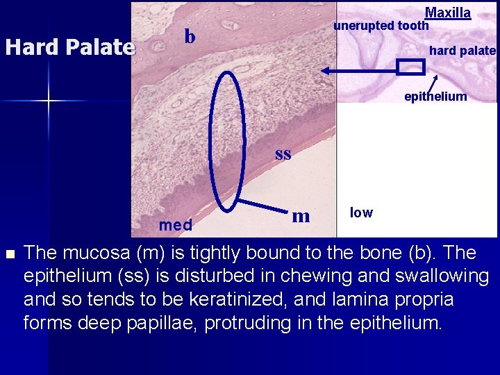 Maxilla Hard Palate unerupted tooth b hard palate epithelium ss med n m low