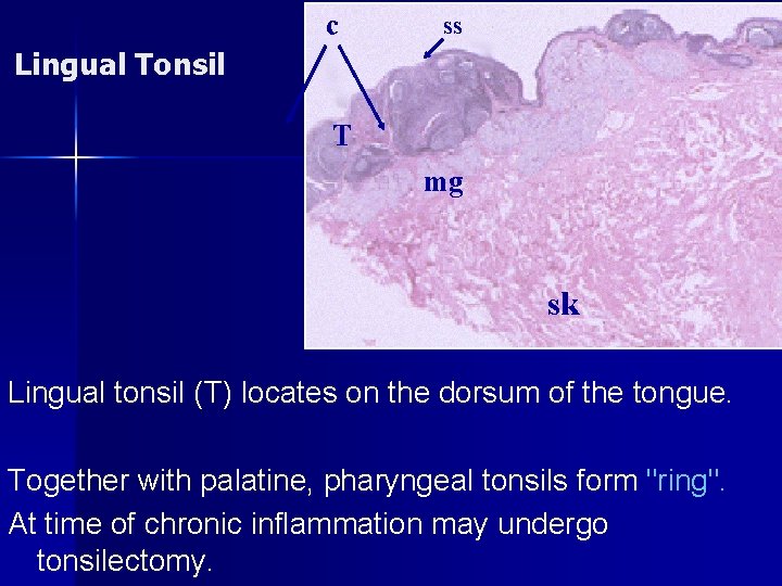 c ss Lingual Tonsil T mg sk Lingual tonsil (T) locates on the dorsum