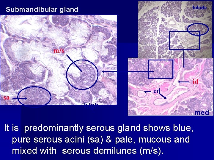 lobule Submandibular gland m/s low id ed sa high It is predominantly serous gland