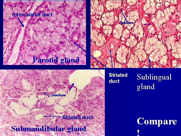 Intercalated duct Demilune demilune Parotid gland sublingual gland Striated duct Sublingual gland Demilune Striated