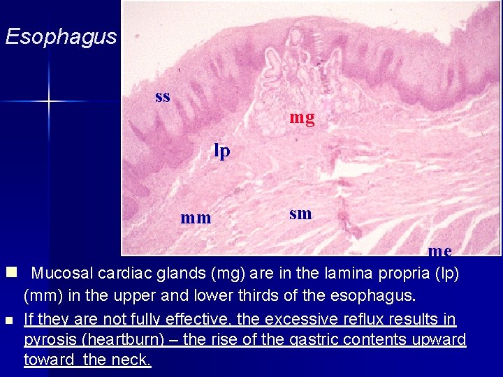 Esophagus ss mg lp mm sm me n Mucosal cardiac glands (mg) are in