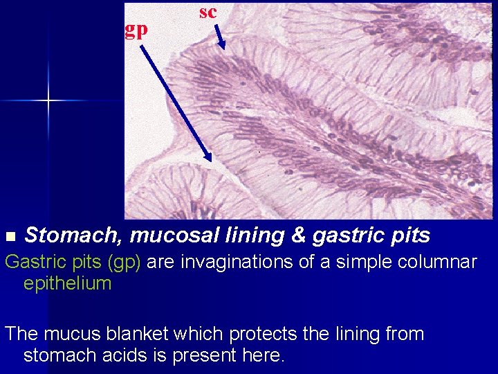 gp n sc Stomach, mucosal lining & gastric pits Gastric pits (gp) are invaginations