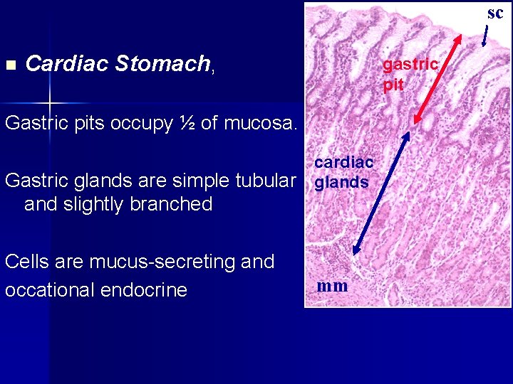 sc n Cardiac Stomach, gastric pit Gastric pits occupy ½ of mucosa. cardiac Gastric