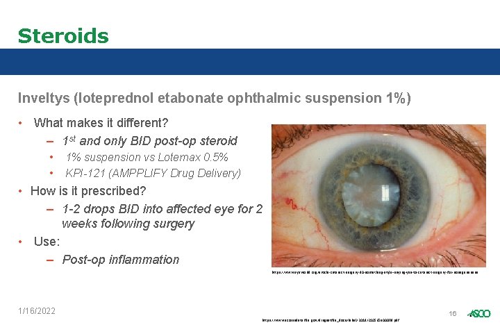 Steroids Inveltys (loteprednol etabonate ophthalmic suspension 1%) • What makes it different? – 1