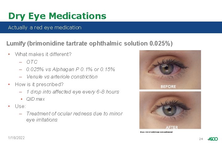 Dry Eye Medications Actually a red eye medication Lumify (brimonidine tartrate ophthalmic solution 0.