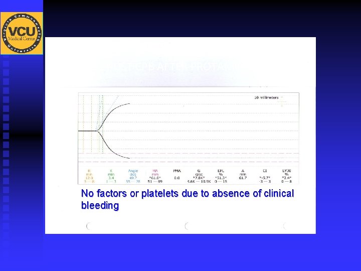 TEG POST CPB AFTER PROTAMINE No factors or platelets due to absence of clinical