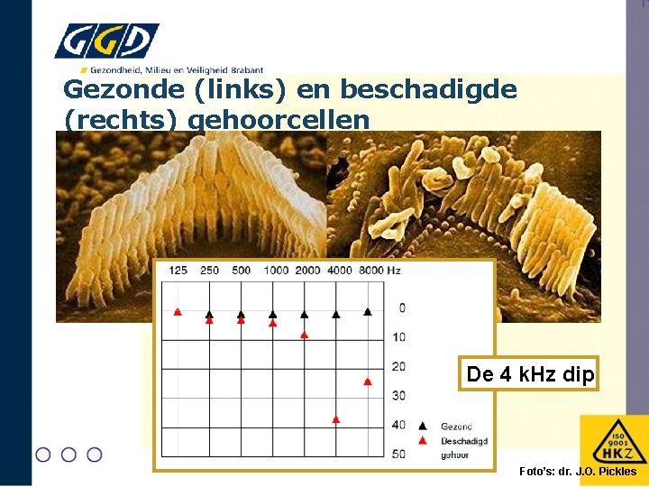 Gezonde (links) en beschadigde (rechts) gehoorcellen De 4 k. Hz dip Foto’s: dr. J.