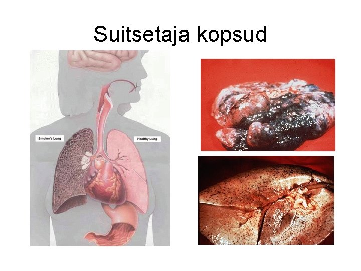 Suitsetaja kopsud 