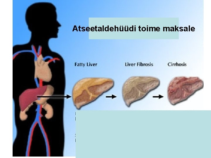 Atseetaldehüüdi toime maksale 