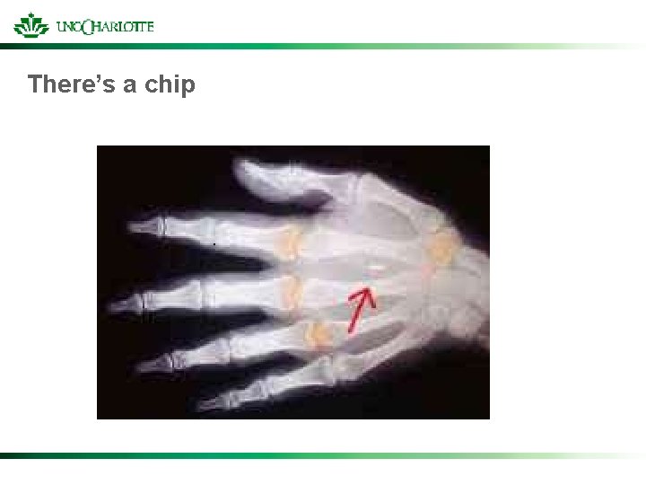 There’s a chip 