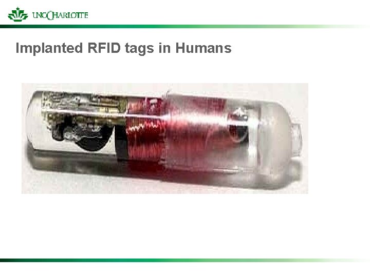 Implanted RFID tags in Humans 