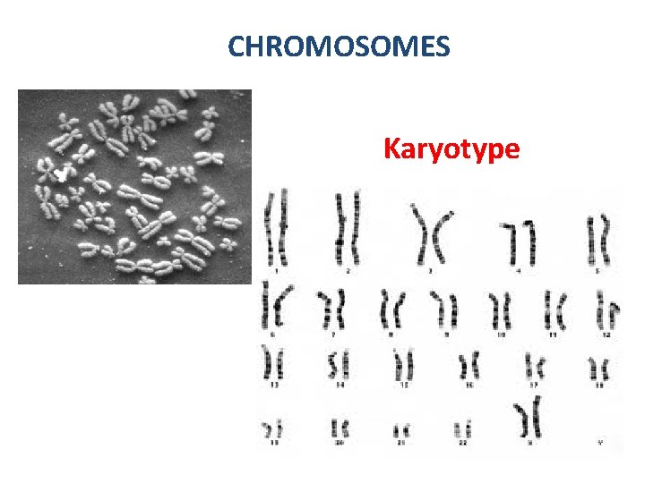 CHROMOSOMES Karyotype CHROMOSOMES Karyotype