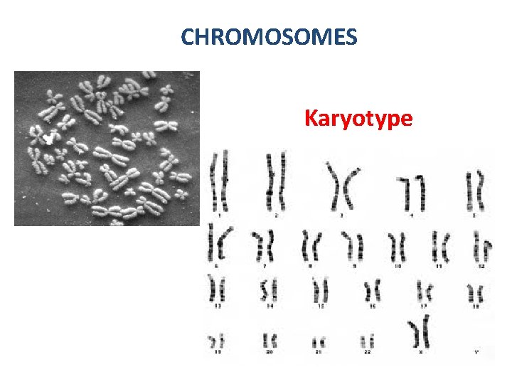 CHROMOSOMES Karyotype 