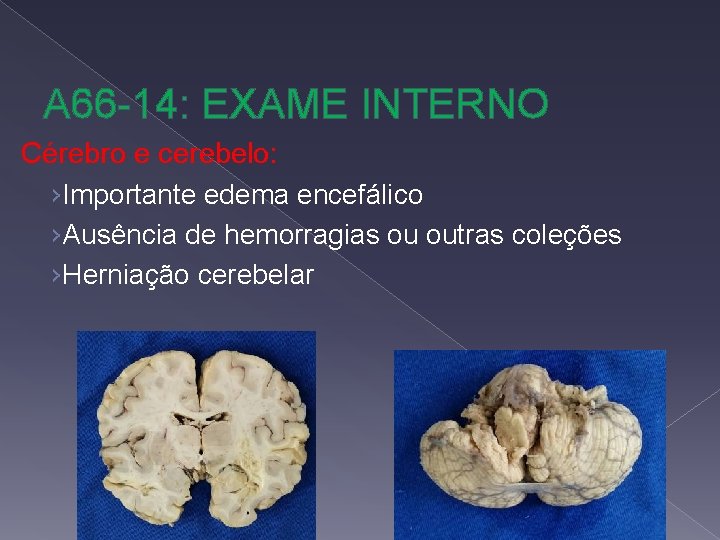 A 66 -14: EXAME INTERNO Cérebro e cerebelo: ›Importante edema encefálico ›Ausência de hemorragias
