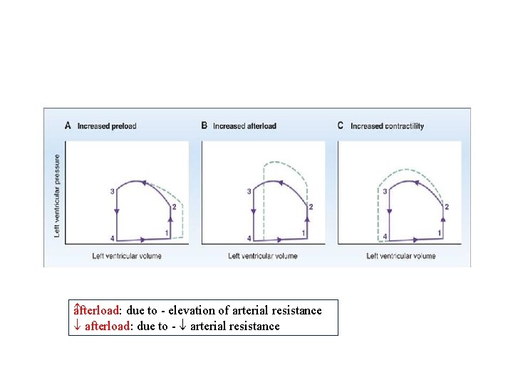 a fterload: due to - elevation of arterial resistance afterload: due to - arterial