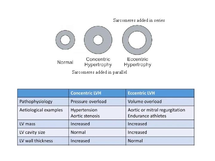 Sarcomeres added in series Sarcomeres added in parallel 