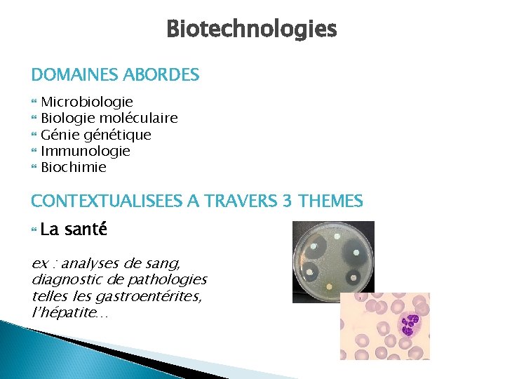 Biotechnologies DOMAINES ABORDES Microbiologie Biologie moléculaire Génie génétique Immunologie Biochimie CONTEXTUALISEES A TRAVERS 3