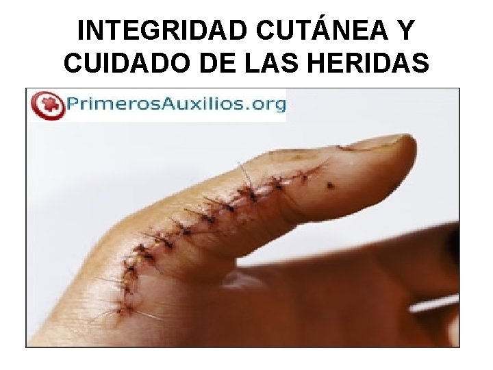 INTEGRIDAD CUTÁNEA Y CUIDADO DE LAS HERIDAS 
