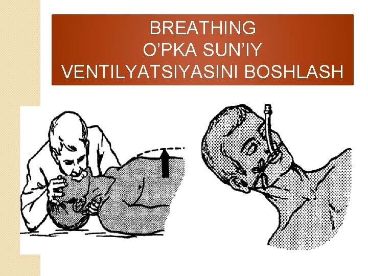 BREATHING O’PKA SUN’IY VENTILYATSIYASINI BOSHLASH 