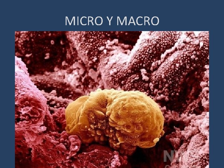 MICRO Y MACRO 