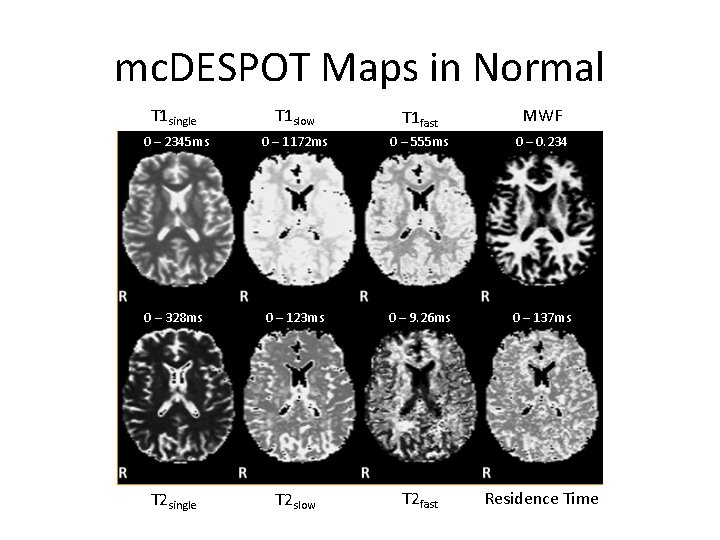 mc. DESPOT Maps in Normal T 1 single T 1 slow T 1 fast