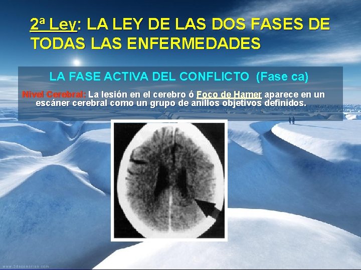 2ª Ley: LA LEY DE LAS DOS FASES DE TODAS LAS ENFERMEDADES LA FASE