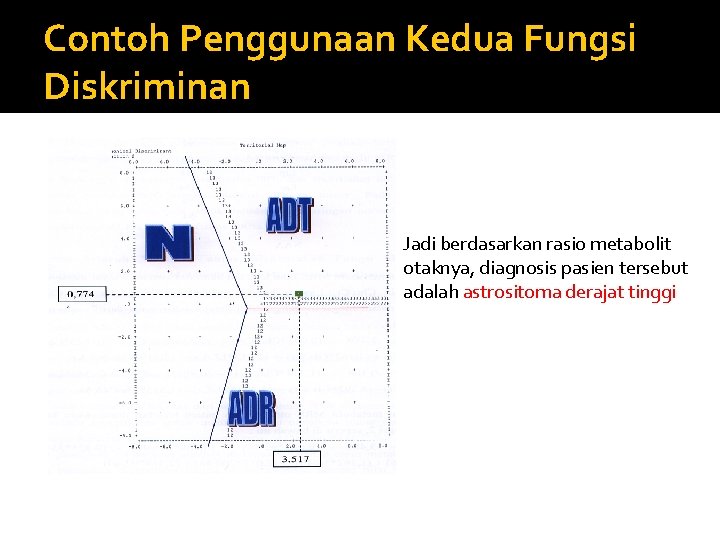 Contoh Penggunaan Kedua Fungsi Diskriminan Jadi berdasarkan rasio metabolit otaknya, diagnosis pasien tersebut adalah