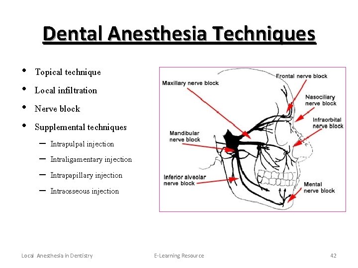 Dental Anesthesia Techniques • • Topical technique Local infiltration Nerve block Supplemental techniques –