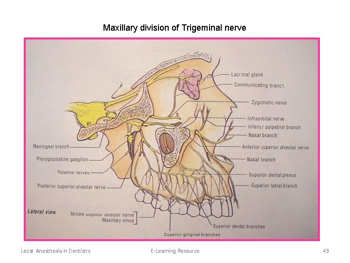 Maxillary division of Trigeminal nerve Local Anesthesia in Dentistry E-Learning Resource 43 