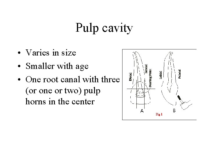 Pulp cavity • Varies in size • Smaller with age • One root canal