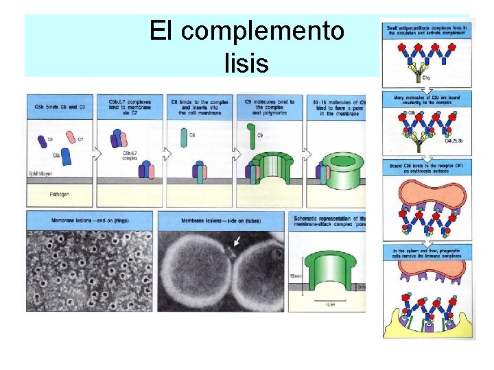 El complemento lisis 