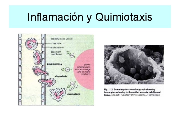 Inflamación y Quimiotaxis 