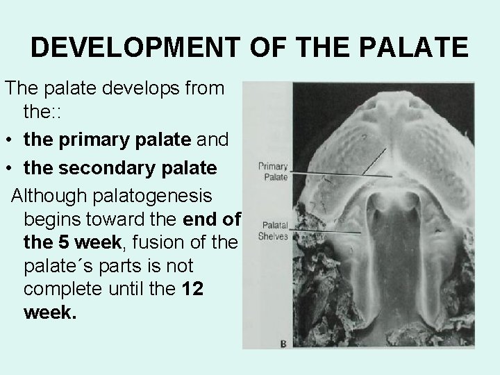 DEVELOPMENT OF THE PALATE The palate develops from the: : • the primary palate