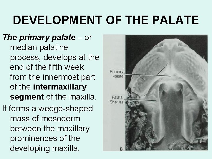 DEVELOPMENT OF THE PALATE The primary palate – or median palatine process, develops at