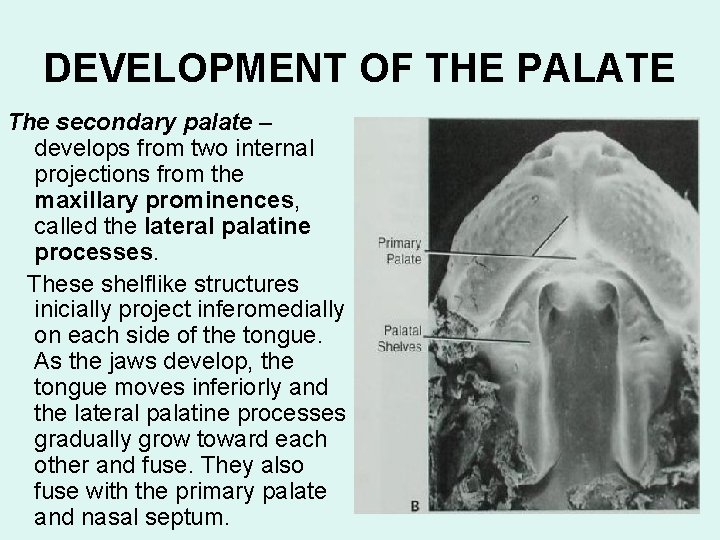 DEVELOPMENT OF THE PALATE The secondary palate – develops from two internal projections from
