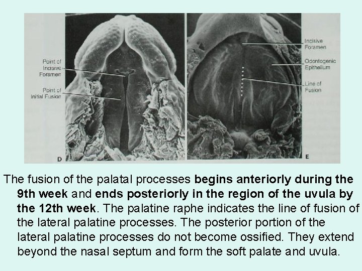 The fusion of the palatal processes begins anteriorly during the 9 th week and
