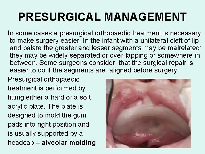 PRESURGICAL MANAGEMENT In some cases a presurgical orthopaedic treatment is necessary to make surgery
