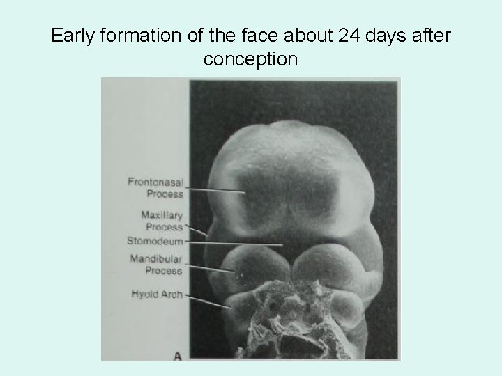 Early formation of the face about 24 days after conception 