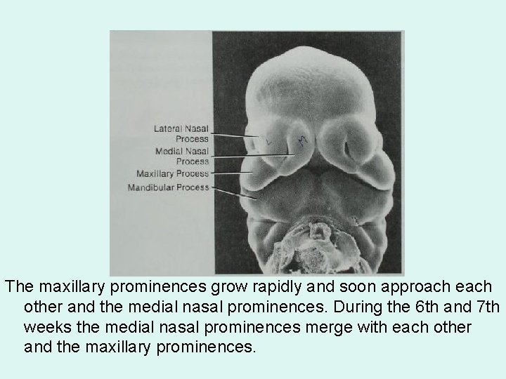 The maxillary prominences grow rapidly and soon approach each other and the medial nasal