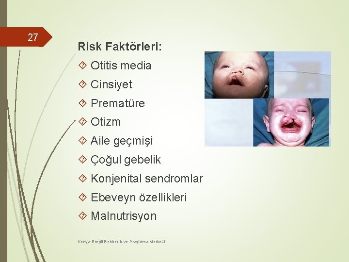 27 Risk Faktörleri: Otitis media Cinsiyet Prematüre Otizm Aile geçmişi Çoğul gebelik Konjenital sendromlar