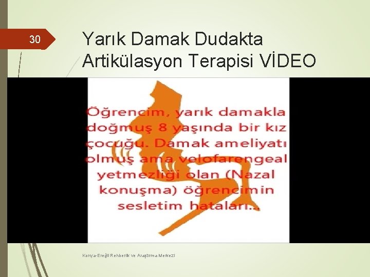 30 Yarık Damak Dudakta Artikülasyon Terapisi VİDEO Konya-Ereğli Rehberlik ve Araştırma Merkezi 