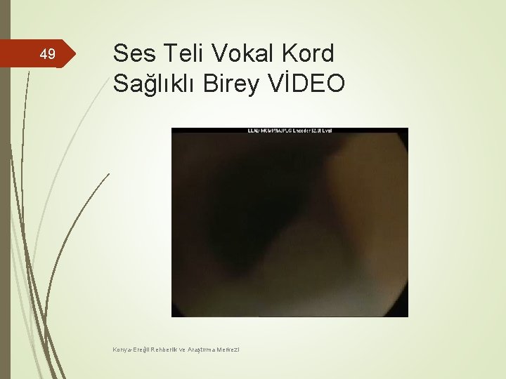 49 Ses Teli Vokal Kord Sağlıklı Birey VİDEO Konya-Ereğli Rehberlik ve Araştırma Merkezi 