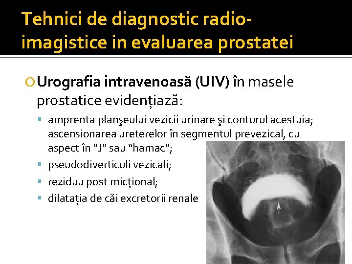 Prostatita cronica abacteriana