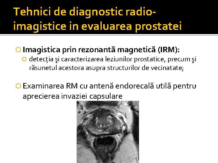 Tehnici de diagnostic radioimagistice in evaluarea prostatei Imagistica prin rezonantă magnetică (IRM): detecția şi Tehnici de diagnostic radioimagistice in evaluarea prostatei Imagistica prin rezonantă magnetică (IRM): detecția şi
