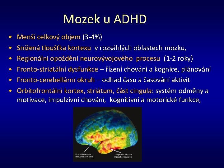 Mozek u ADHD • • • Menší celkový objem (3 -4%) Snížená tloušťka kortexu