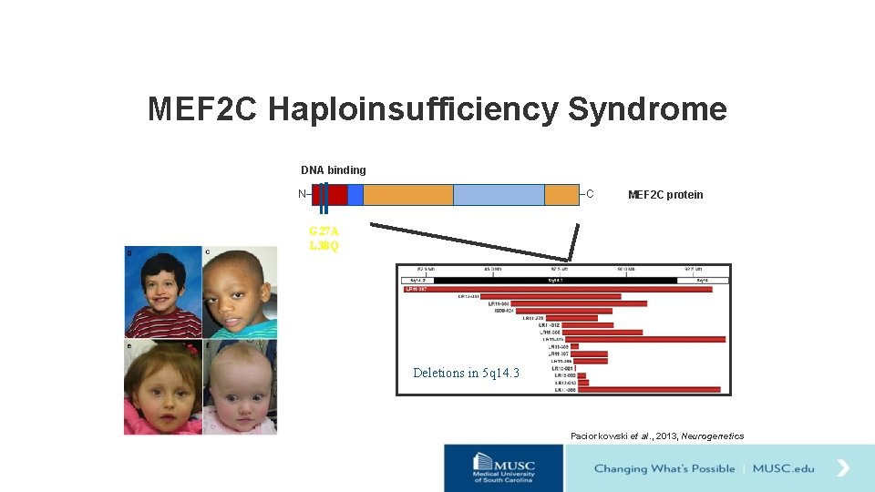MEF 2 C Haploinsufficiency Syndrome DNA binding N C MEF 2 C protein G